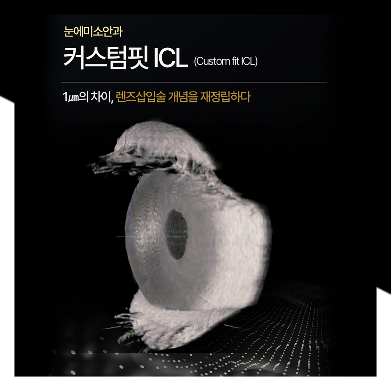 ICL 눈에미소안과
