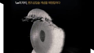 ICL 눈에미소안과